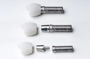Kidbrooke Dental Implants Dentist Announces Consultations at Kidbrooke Village Dentist (Smile 4 U)